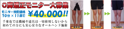 Ｏ脚整体モニター大募集